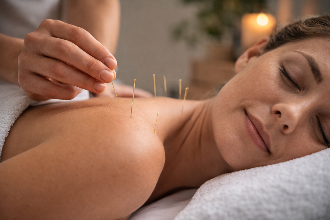 Pain Relief Acupuncture: Natural Solutions for Chronic and Acute Pain