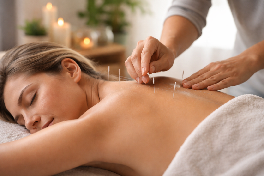Acupuncture for Pain Relief: How Chinese Medicine Treats Chronic Pain Naturally
