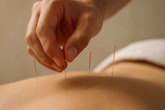 Acupuncture Treatment in Doncaster | Pain Relief & Wellness by Dr. Lawrence Yao